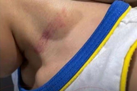 Criança com autismo e problema cardíaco é agredida por cuidador em escola do Ceará