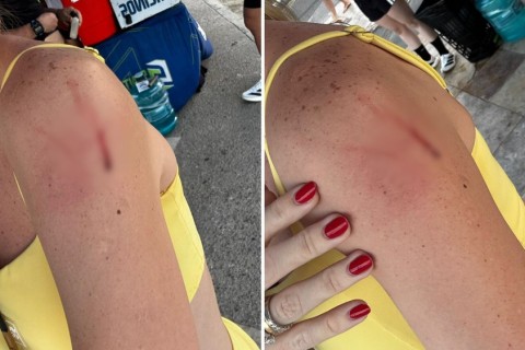 Corredoras sofrem agressões de mulher em situação de rua na Beira Mar de Fortaleza-CE