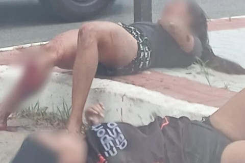 Acidente em Barbalha no Ceará deixa duas mulheres feridas, uma com fratura exposta