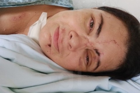 'Ouvi médicos dizer que eu não ia mais reagir', diz mulher que ficou em coma após agressão do ex