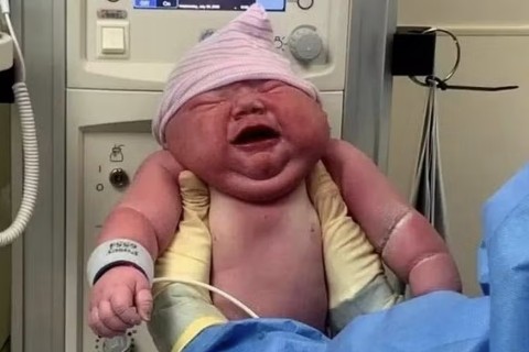 Mulher dá à luz a bebê de quase 6 kg e viraliza nas redes sociais: ‘Achei que não fosse sobreviver’