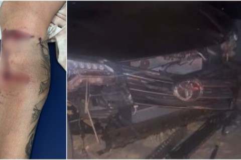 Motorista deixou pessoas gravemente feridas após atropelar multidão na saída de festa em Fortaleza-CE